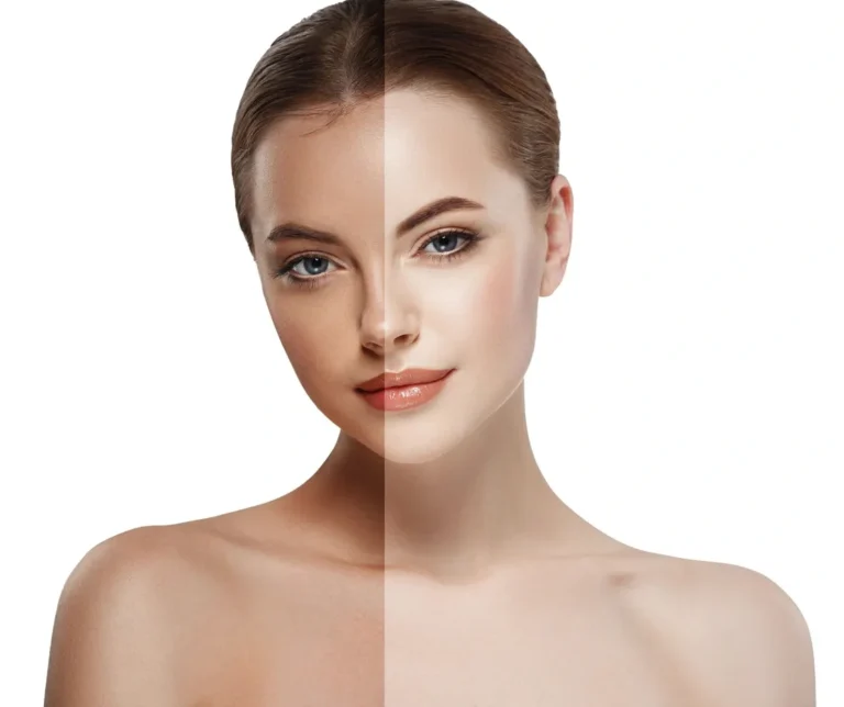 How To Get Rid Of A Sun Tan Naturally